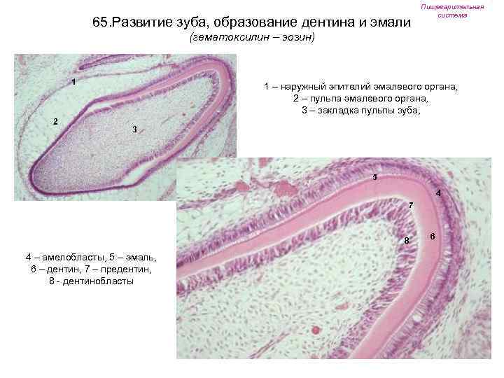 65. Развитие зуба, образование дентина и эмали Пищеварительная система (гематоксилин – эозин) 1 2