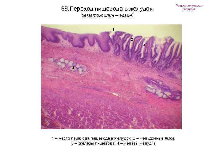 Пищеварительная система 69. Переход пищевода в желудок (гематоксилин – эозин) 1 2 2 3