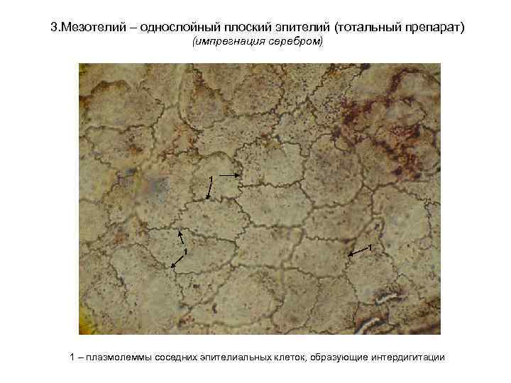 3. Мезотелий – однослойный плоский эпителий (тотальный препарат) (импрегнация серебром) 1 1 – плазмолеммы