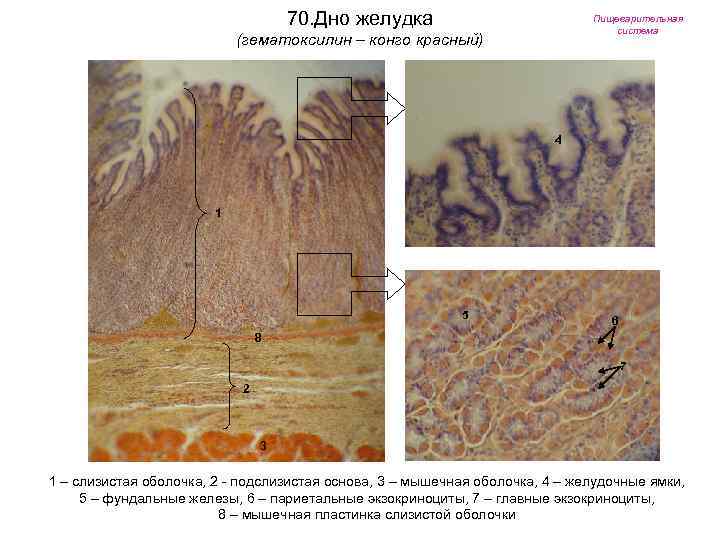70. Дно желудка Пищеварительная система (гематоксилин – конго красный) 4 1 5 6 8