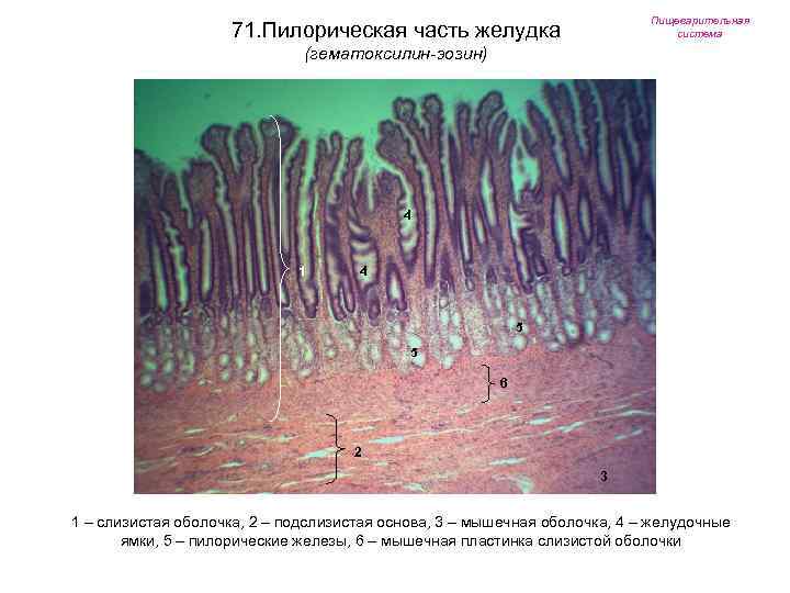 Пищеварительная система 71. Пилорическая часть желудка (гематоксилин-эозин) 4 1 4 5 5 6 2