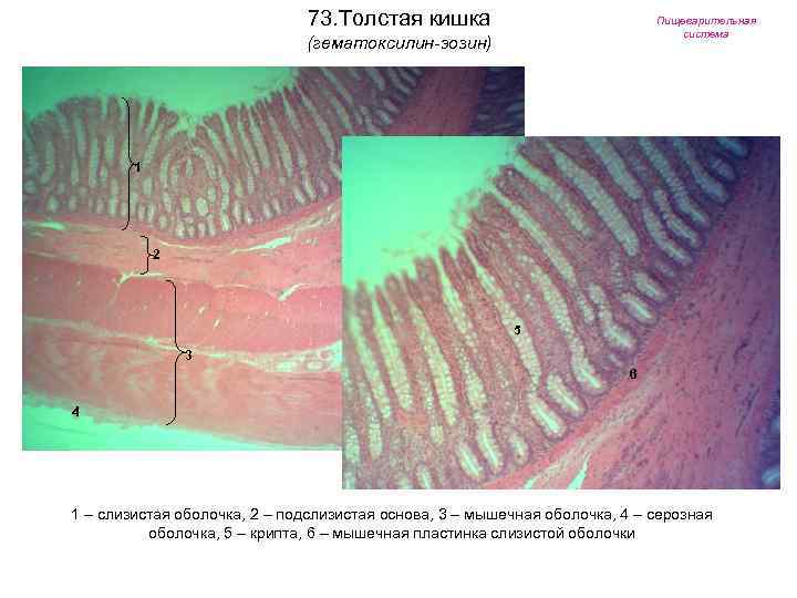 73. Толстая кишка Пищеварительная система (гематоксилин-эозин) 1 2 5 3 6 4 1 –