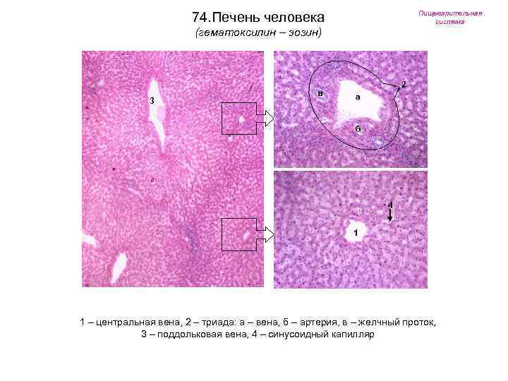74. Печень человека Пищеварительная система (гематоксилин – эозин) 3 в 2 а б 4