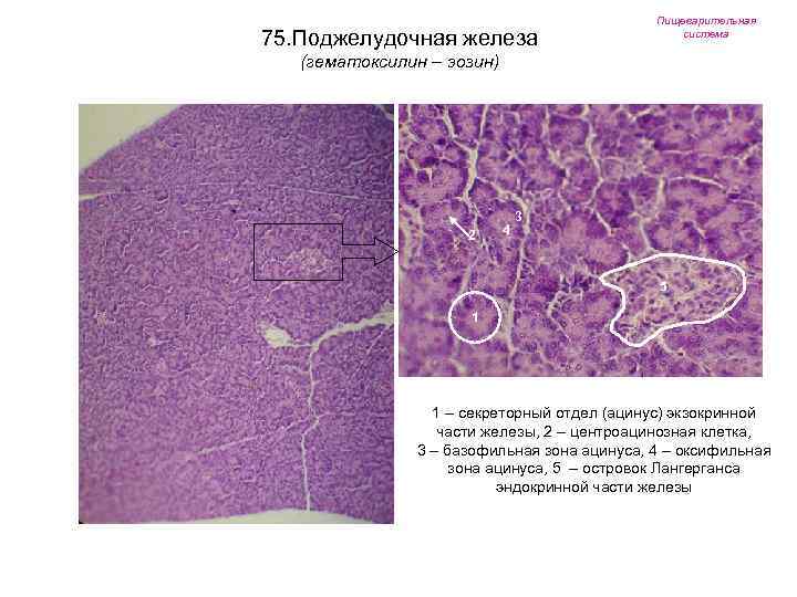 75. Поджелудочная железа Пищеварительная система (гематоксилин – эозин) 2 4 3 5 1 1