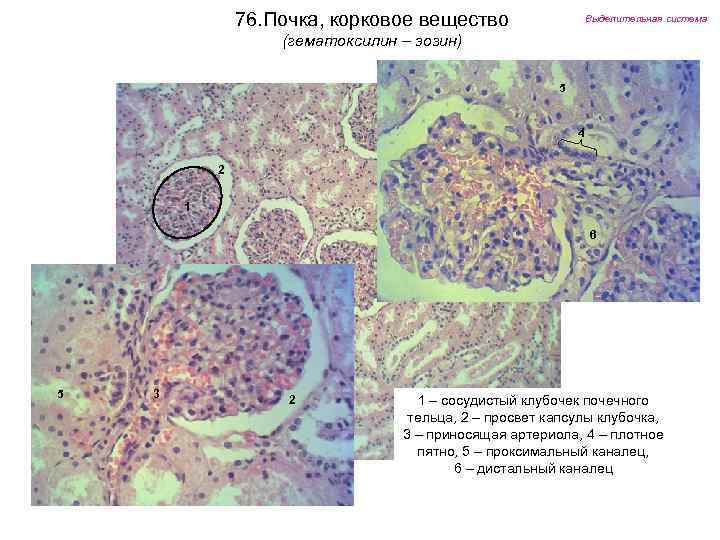 76. Почка, корковое вещество Выделительная система (гематоксилин – эозин) 5 4 2 1 6
