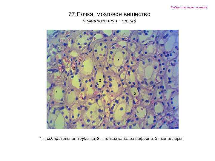 Выделительная система 77. Почка, мозговое вещество (гематоксилин – эозин) 1 3 2 1 –