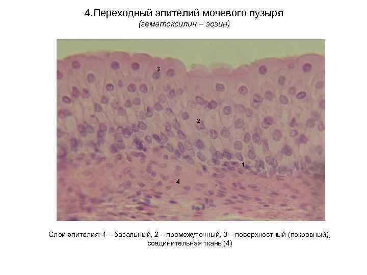 4. Переходный эпителий мочевого пузыря (гематоксилин – эозин) 3 2 1 4 Слои эпителия: