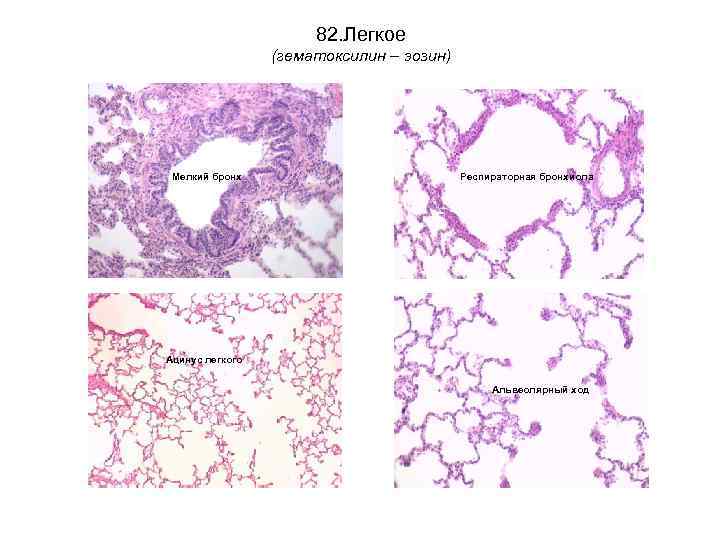 82. Легкое (гематоксилин – эозин) Мелкий бронх Респираторная бронхиола Ацинус легкого Альвеолярный ход 