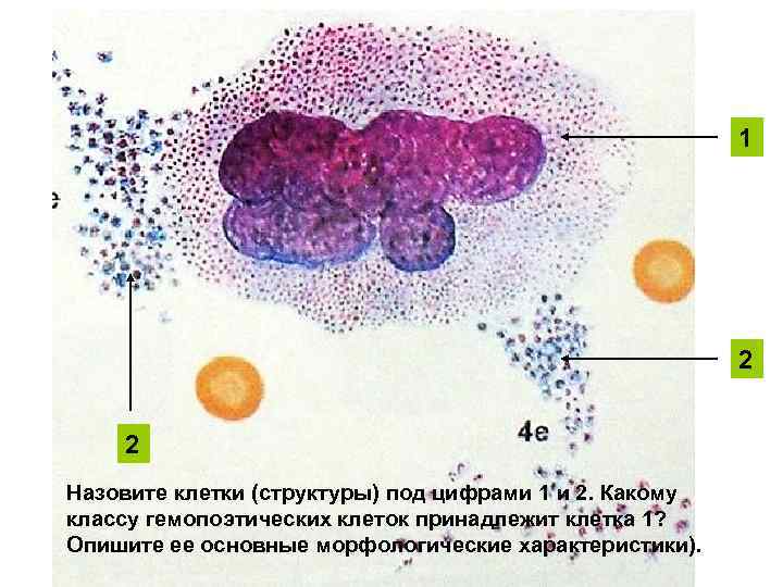 1 2 2 Назовите клетки (структуры) под цифрами 1 и 2. Какому классу гемопоэтических