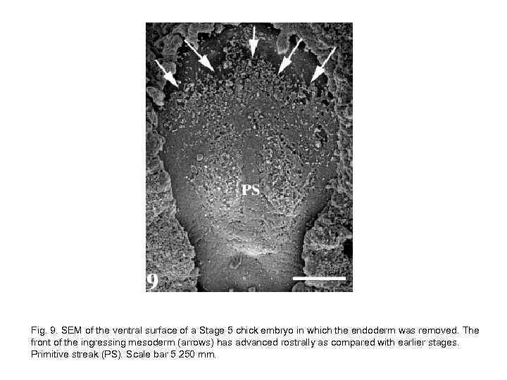 Fig. 9. SEM of the ventral surface of a Stage 5 chick embryo in