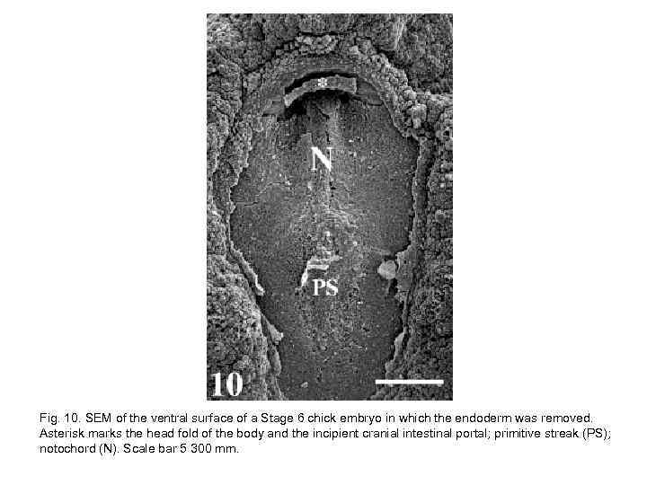 Fig. 10. SEM of the ventral surface of a Stage 6 chick embryo in