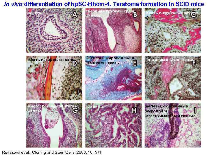In vivo differentiation of hp. SC-Hhom-4. Teratoma formation in SCID mice железа «нервная трубка»