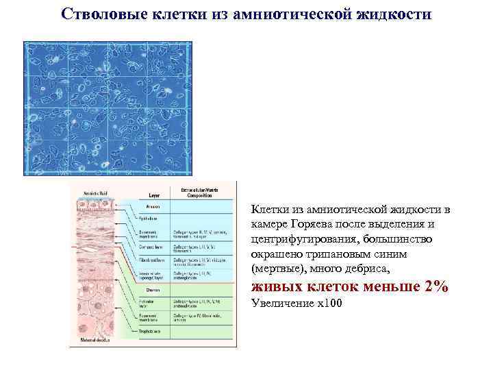 Стволовые клетки из амниотической жидкости Клетки из амниотической жидкости в камере Горяева после выделения