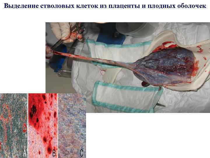 Выделение стволовых клеток из плаценты и плодных оболочек 