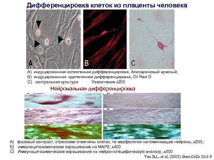 Дифференцировка клеток из плаценты человека A) индуцированная остеогенная дифференцировка, Ализариновый красный; B) индуцированная адипогенная