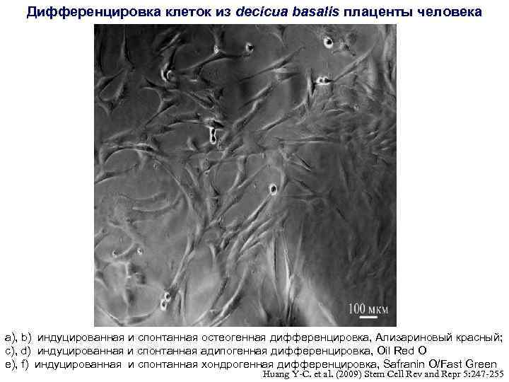 Дифференцировка клеток из decicua basalis плаценты человека a), b) индуцированная и спонтанная остеогенная дифференцировка,
