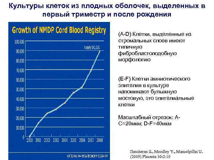 Культуры клеток из плодных оболочек, выделенных в первый триместр и после рождения (A-D) Клетки,