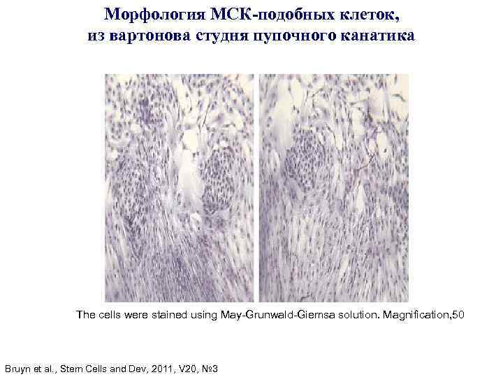 Морфология МСК-подобных клеток, из вартонова студня пупочного канатика The cells were stained using May-Grunwald-Giemsa