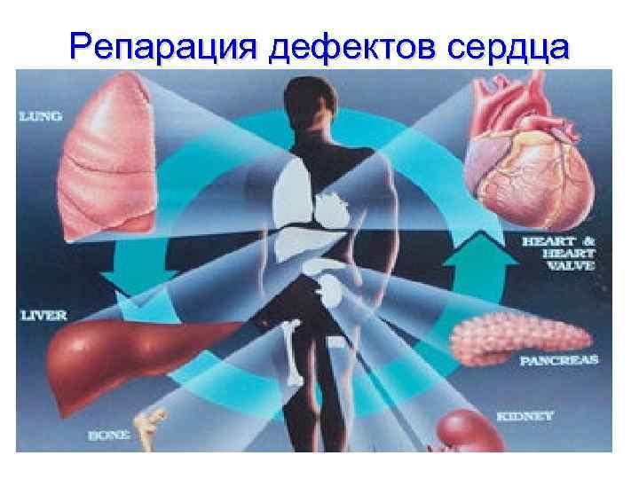 Репарация дефектов сердца 