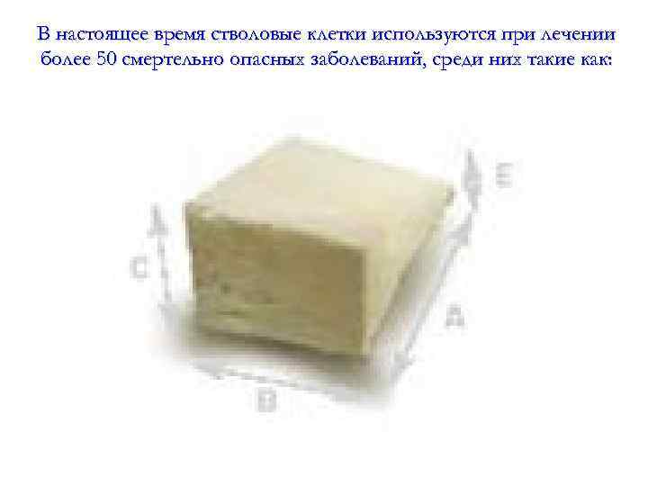 В настоящее время стволовые клетки используются при лечении более 50 смертельно опасных заболеваний, среди