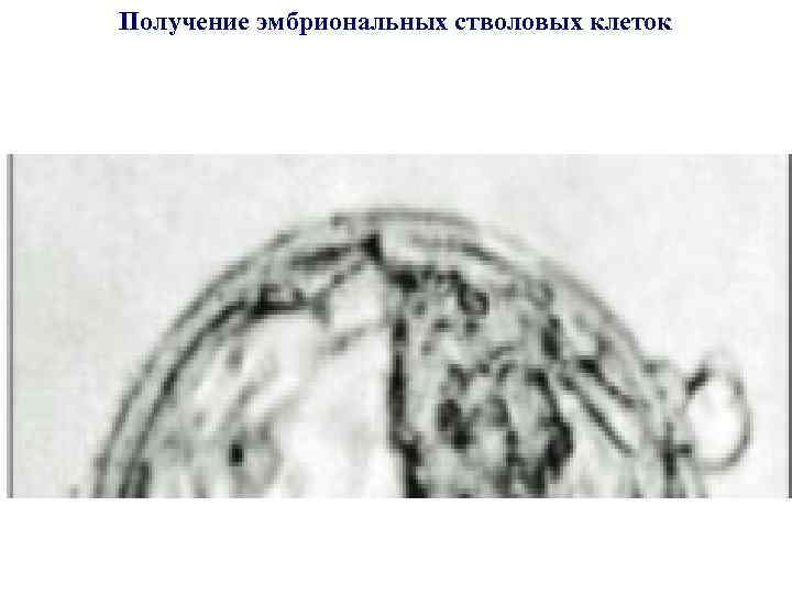 Получение эмбриональных стволовых клеток 