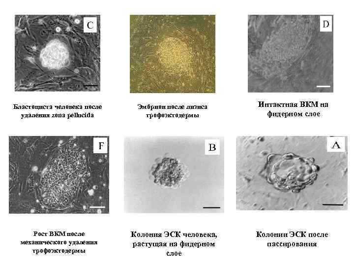 Бластоциста человека после удаления zona pellucida Эмбрион после лизиса трофоэктодермы Интактная ВКМ на фидерном