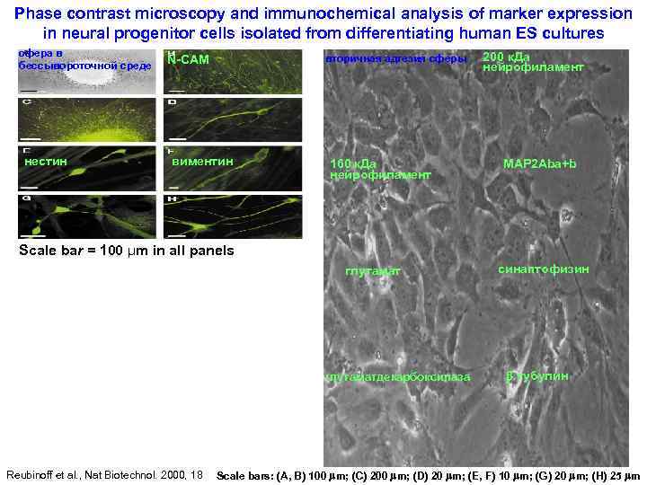 Phase contrast microscopy and immunochemical analysis of marker expression in neural progenitor cells isolated