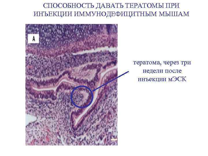 СПОСОБНОСТЬ ДАВАТЬ ТЕРАТОМЫ ПРИ ИНЪЕКЦИИ ИММУНОДЕФИЦИТНЫМ МЫШАМ тератома, через три недели после инъекции м.
