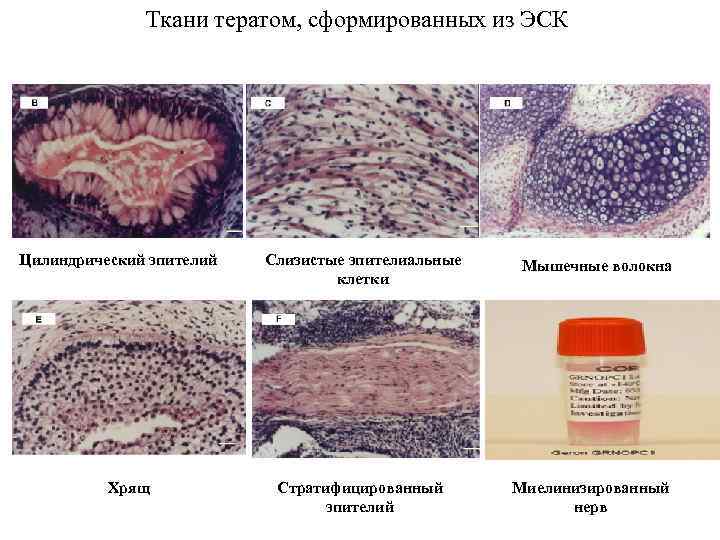 Ткани тератом, сформированных из ЭСК Цилиндрический эпителий Хрящ Слизистые эпителиальные клетки Мышечные волокна Стратифицированный