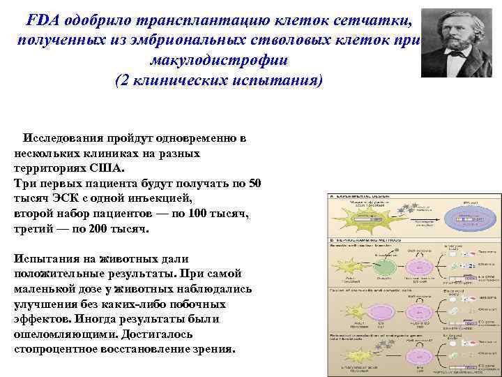FDA одобрило трансплантацию клеток сетчатки, полученных из эмбриональных стволовых клеток при макулодистрофии (2 клинических