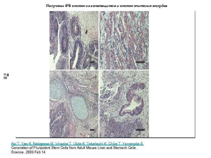 Получены IPS клеток из гепатоцитов и клеток эпителия желудка Aoi T, Yae K, Nakagawa