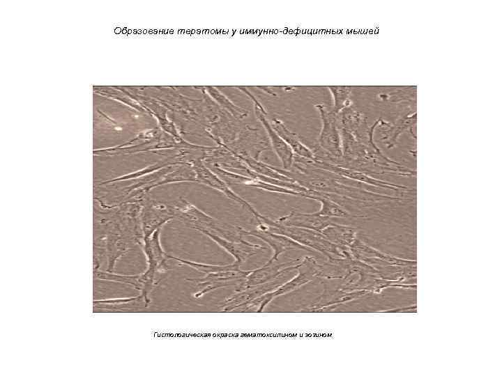 Образование тератомы у иммунно-дефицитных мышей Гистологическая окраска гематоксилином и эозином 
