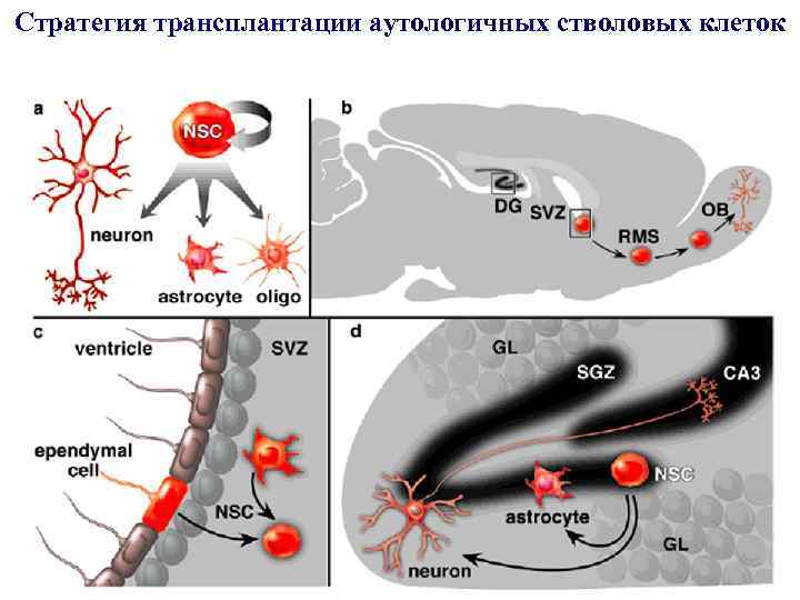Стратегия трансплантации аутологичных стволовых клеток 