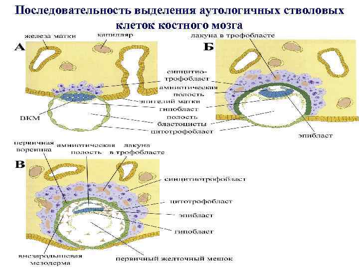 Последовательность выделения аутологичных стволовых клеток костного мозга 