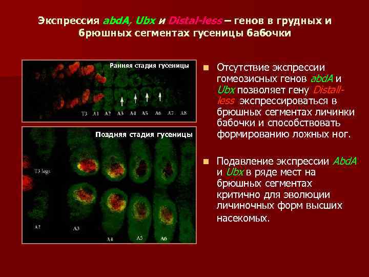 Экспрессия abd. A, Ubx и Distal-less – генов в грудных и брюшных сегментах гусеницы