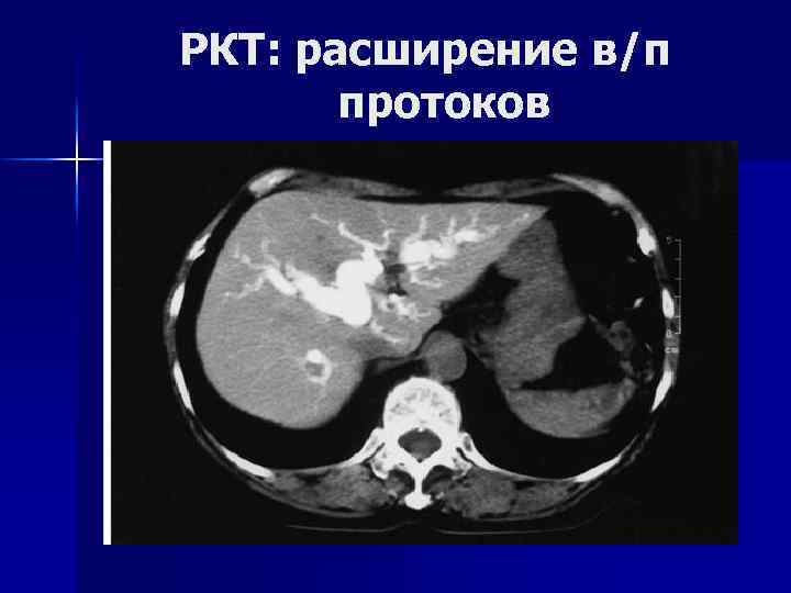 Механическая желтуха карта вызова