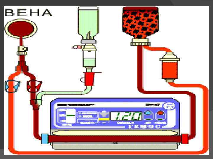  Гемосорбция используется для удаления из крови токсических веществ с достаточно крупными молекулами (например,