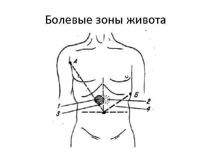 Болевые зоны живота 