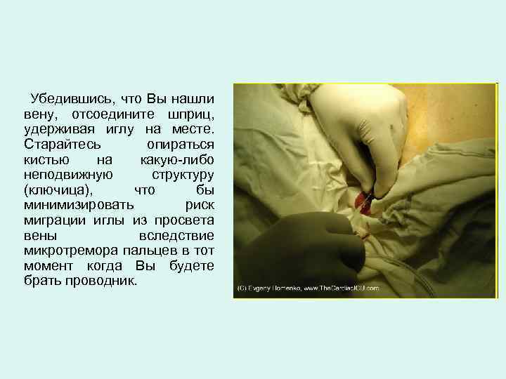 Убедившись, что Вы нашли вену, отсоедините шприц, удерживая иглу на месте. Старайтесь опираться кистью