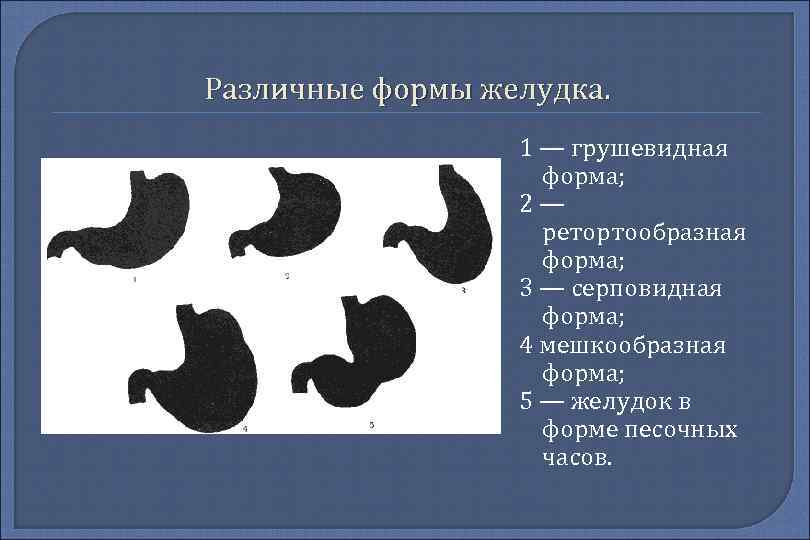 Виды желудка. Каскадная форма желудка. Ретортообразная форма желудка. Формы желудка анатомия. Формы желудка в зависимости от телосложения.