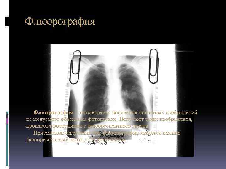 Флюорография раз в год. Флюорография методика. Флюорография радиация. Флюорография излучение. Флюорография схема.