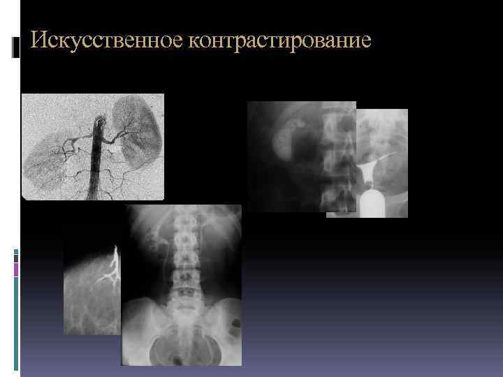 Методы контрастирования изображения