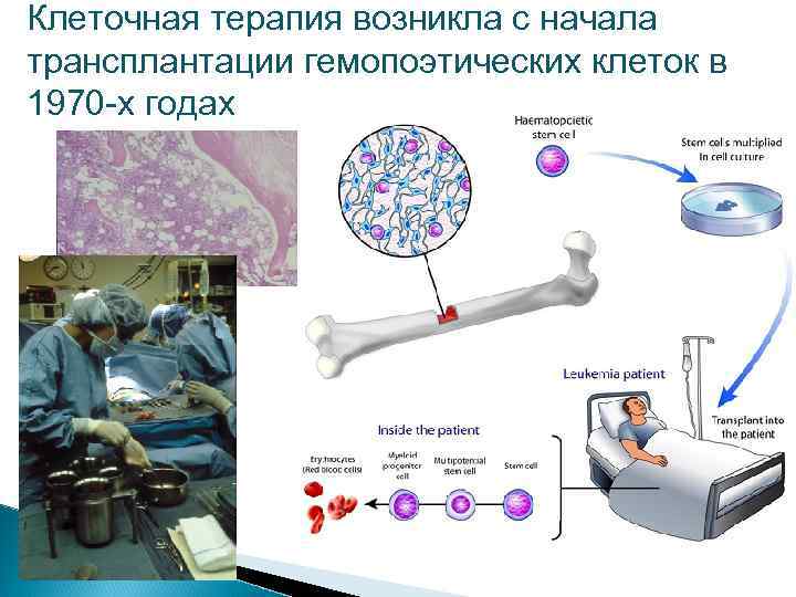 Карта клеточная терапия