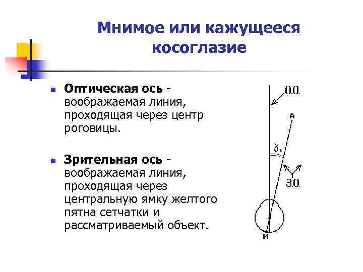 Мнимое или кажущееся косоглазие n n Оптическая ось воображаемая линия, проходящая через центр роговицы.