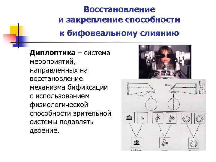 Восстановление и закрепление способности к бифовеальному слиянию Диплоптика – система мероприятий, направленных на восстановление