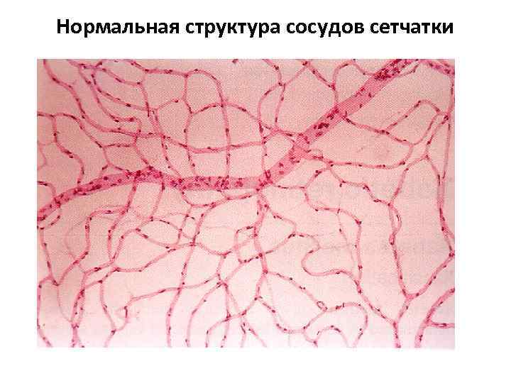 Нормальная структура сосудов сетчатки 