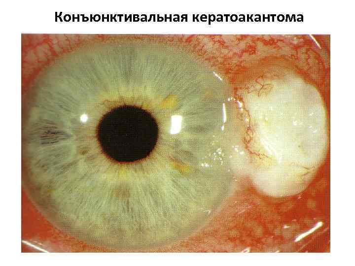 Если глаз человека строит изображение далеких предметов перед сетчаткой то глаз страдает