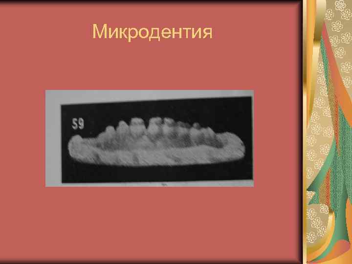 Микродентия 