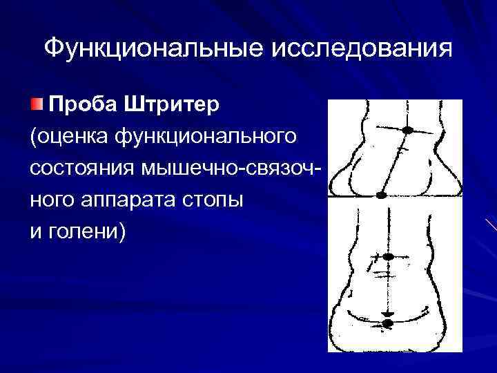 Функциональные исследования Проба Штритер (оценка функционального состояния мышечно-связочного аппарата стопы и голени) 