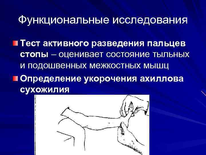 Функциональные исследования Тест активного разведения пальцев стопы – оценивает состояние тыльных и подошвенных межкостных